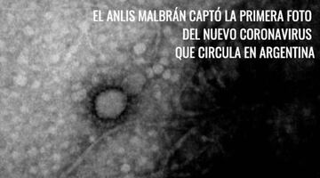 Coronavirus: toman la primera imagen del virus que circula en Argentina