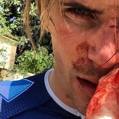 Brutal paliza a Yoann Offredo mientras se entrenaba