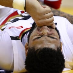 Anthony Davis, con una lesión en un dedo, baja de 1 a 2 semanas