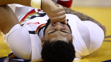 OAKLAND, CALIFORNIA - JANUARY 16: Anthony Davis #23 of the New Orleans Pelicans grimaces after being injured during their game against the Golden State Warriors at ORACLE Arena on January 16, 2019 in Oakland, California. NOTE TO USER: User expressly acknowledges and agrees that, by downloading and or using this photograph, User is consenting to the terms and conditions of the Getty Images License Agreement.   Ezra Shaw/Getty Images/AFP
 == FOR NEWSPAPERS, INTERNET, TELCOS &amp; TELEVISION USE ONLY ==