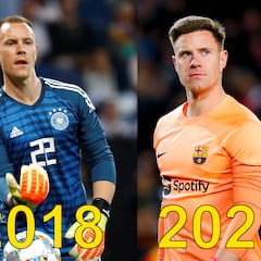 Los futbolistas que se han hecho injerto capilar