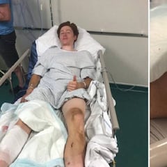 Grave lesión de Jorgenson en Roubaix por un freno de disco