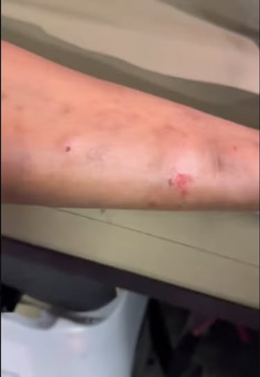 Así quedó la pierna de Kevin Mier tras la dura entrada de Adalberto Carrasquilla en el Cruz Azul vs Pumas