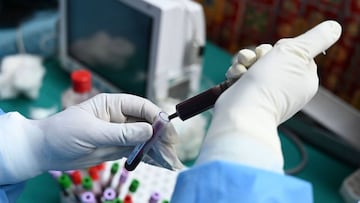 A health worker transfers in a test tube a blood sample donated by a recovered COVID-19 coronavirus patient for plasma at a donation camp in Srinagar on July 22, 2020. (Photo by TAUSEEF MUSTAFA / AFP)