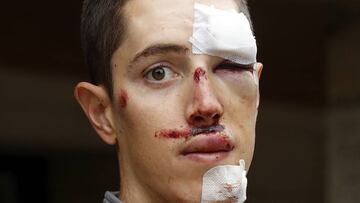 05/09/18 VUELTA A CICLISTA A ESPAÃA 2018 ETAPA 11 SIMONI PETILLI CICLISTA DEL UAE TEAM EMIRATES DESPUES DE LA CAIDA