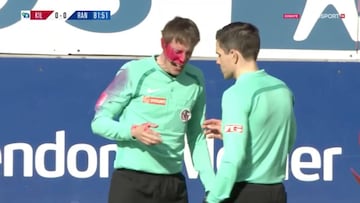 Se van a cargar el fútbol: ¡dejan ciego a un árbitro en Noruega en un ataque con un spray!
