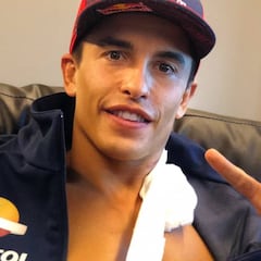 "En un deporte de riesgo siempre hay un año que toca pringar"