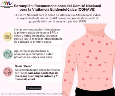 Así puedes detectar los primeros síntomas del sarampión, enfermedad que ya cobró vidas en México