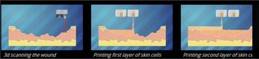 Esta impresora 3D imprime piel con tinta de células para curar quemaduras graves