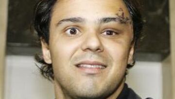 Massa se montó en un kart por primera vez desde el accidente en Hungría