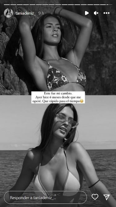 El cambio de Tania, de ‘La isla de las tentaciones’, tras operarse el pecho