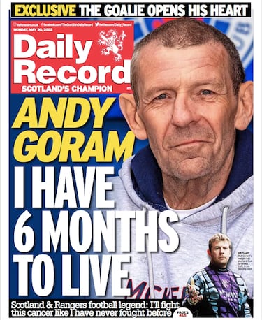 Andy Goram, ex Rangers y Manchester United, anuncia que le quedan seis meses de vida