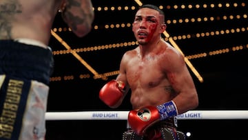 Médicos dijeron a la cadena ESPN que Teófimo López peleó contra George Kambosos con pneumomediastino y pudo haber muerto en el ring.
