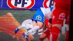 La terrible lesión de Eugenio Mena