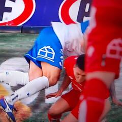 La terrible lesión de Eugenio Mena