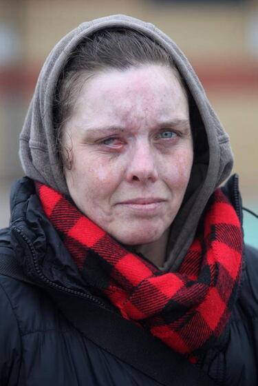 Presume en Facebook de quemar con ácido la cara de una mujer