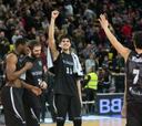Marko Todorovic también se lesiona en el Bilbao Basket