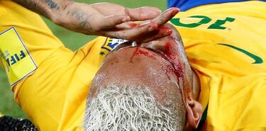 Así acabó Neymar tras el duro codazo del boliviano Duk