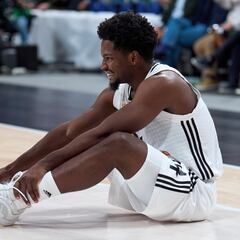 Feliz sufre una rotura de la fascia plantar