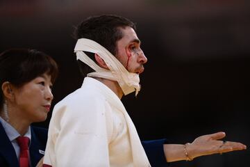 El judoca espa?ol Alberto Gaitero ha ca¨ªdo en primera ronda frente al ucraniano Heorhi Zantaraia en una pelea muy dura, en la que el espa?ol acab¨® con casi toda la cara vendada.