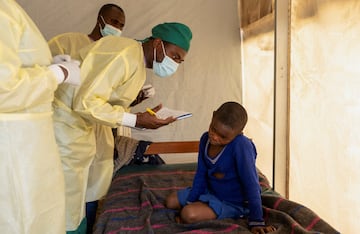 Dr. Tresor Wakilongo verifies the evolution of skin lesions on the ear of Innocent, suffering from Mpox.