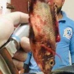 Salvan la vida de un pescador egipcio tras extraer un pez vivo de su tráquea