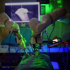 Un robot realiza una complicada operación sin ayuda humana