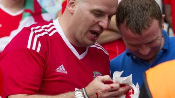 Bale le rompió la nariz a un aficionado en el calentamiento