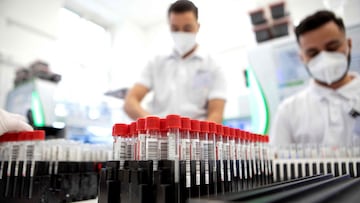 Employees examine the coronavirus (Covid-19) PCR gargle tests in the LifeBrain laboratory in Vienna on February 1, 2022. - Throughout the day, vans loaded with bags full of Covid PCR test kits arrive at a Vienna laboratory, currently analysing an average 