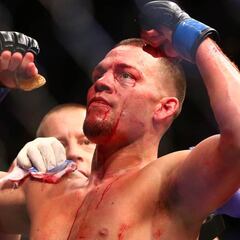 Nate Díaz: polémicas, UFC y boxeo