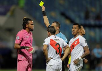 Colombia cayó ante Perú 1-2 en la tercera fecha de la Copa América. Ahora, tendrá que pensar en Brasil 