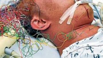 <b>DOLOR. </b>El boxeador está conectado a las máquinas del hospital en el que fue ingresado.