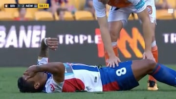 Vargas se vuelve a lesionar de gravedad: fractura de tibia