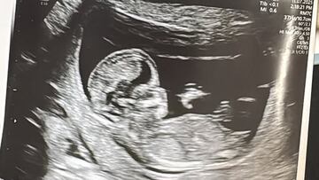 El embarazo que alegra al fútbol chileno: “Sólo tu papá, Dios, la Virgen y yo sabemos cuánto soñamos con este momento”