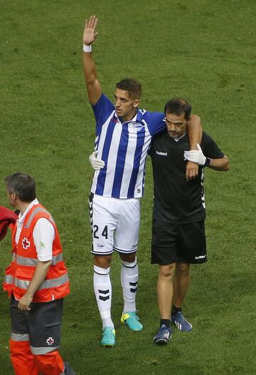 Lesión de Feddal.