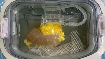 Científicos chinos dan un nuevo paso y crean un riñón “universal” compatible con cualquier tipo de sangre