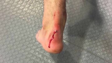 Tuzos publicó una imagen en la que aparece el pie del atacante mexicano sangrado, jugador que regresó a las canchas después de un mes de lesión.