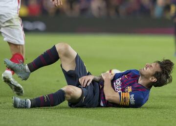 Messi fractured his right arm during the Sevilla match