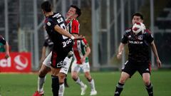 Muestran cómo le quedó el rostro a jugador de Palestino tras patada de Jeyson Rojas