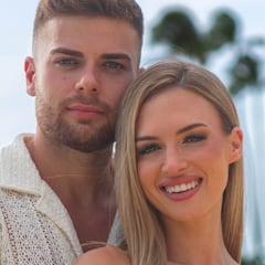 Un experto en estética analiza el cambio físico de Almudena, de ‘La isla de las tentaciones’, y sentencia: “No me engaña”