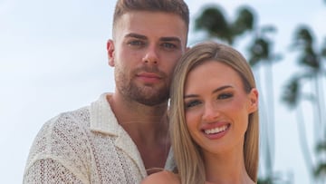 Un experto en estética analiza el cambio físico de Almudena, de ‘La isla de las tentaciones’, y sentencia: “No me engaña”