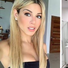 Oriana Marzoli se retoca los glúteos con un novedoso y doloroso tratamiento