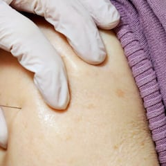 Ocho trabajadores de una residencia alemana reciben una sobredosis de la vacuna de Pfizer