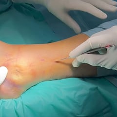 El motivo por el que los cirujanos van vestidos de verde o azul en las operaciones