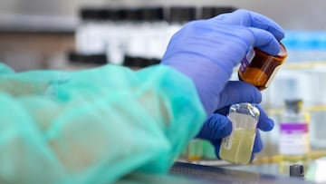 A scientist works at the microbiology laboratory of the Gregorio Maranon General Hospital in Madrid on June 5, 2020. - Microbiologists have to deactivate the virus in the samples prior to proceeding to the extraction of the ribonucleic acid (RNA) in order