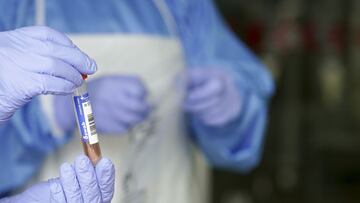 La OMS señala sus tres preocupaciones tras hallar dos nuevas subvariantes