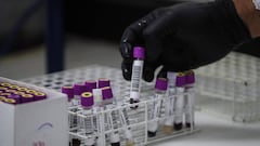 Argentina producirá la vacuna de Oxford: cuándo estará disponible y cuánto costará