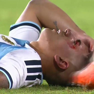 Millones, patadas... y Messi