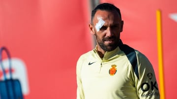 El delantero mallorquinista, Vedat Muriqi, herido en un ojo.