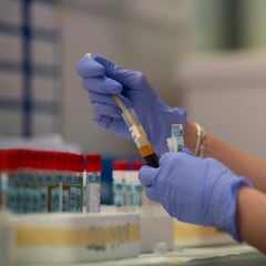 Un medicamento español a base de parásitos moleculares para matar al coronavirus